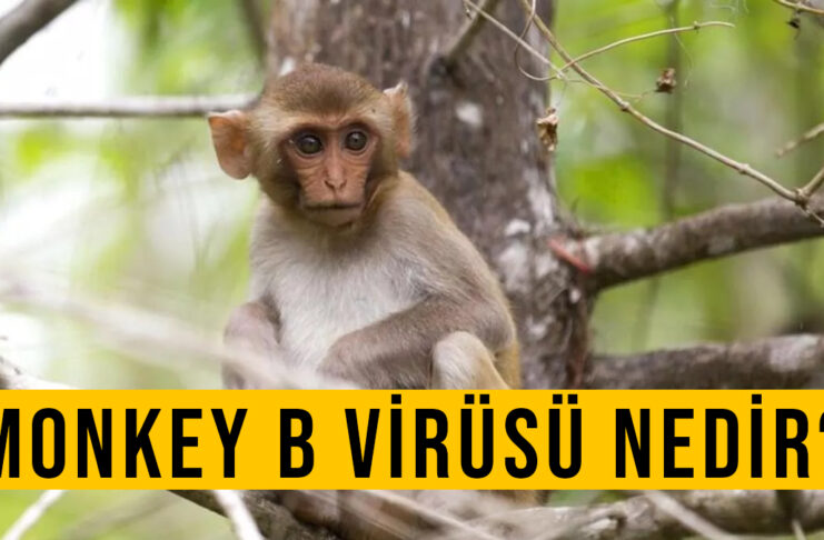 MONKEY B VİRÜSÜ NEDİR